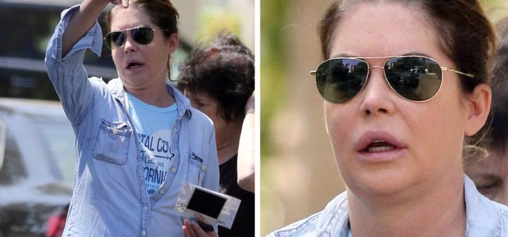 lara flynn boyle plastische chirurgie
